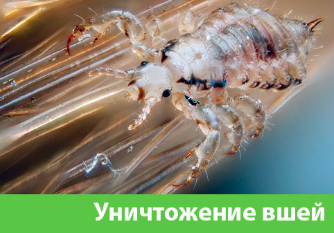 Уничтожение вшей в городе Дубна